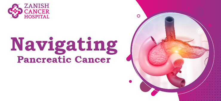 Navigating Pancreatic Cancer