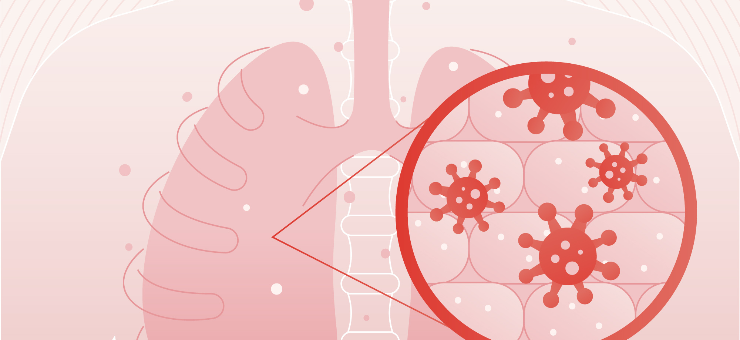 Smoking Epidemic and Lung Cancer