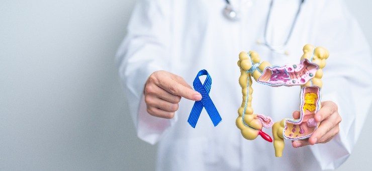 Colon Cancer Treatment: Hope, Healing & Advanced Care at Zanish Cancer Hospital