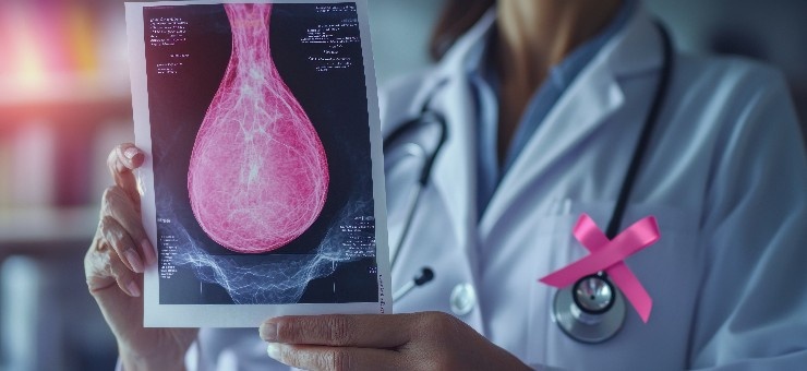 Precision Oncology for Breast Cancer: Personalized Treatment at Zanish Cancer Hospital