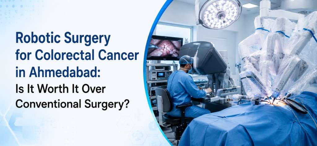 Robotic Surgery For Colorectal Cancer In Ahmedabad: A Patient’s Guide
