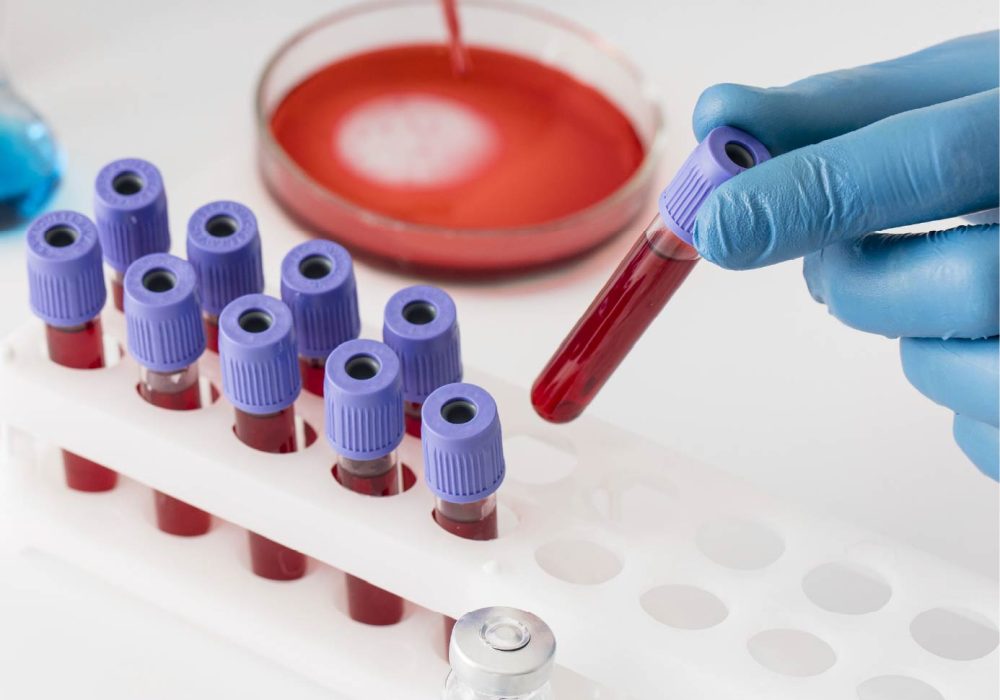 Blood cancer 665-465.5px-01