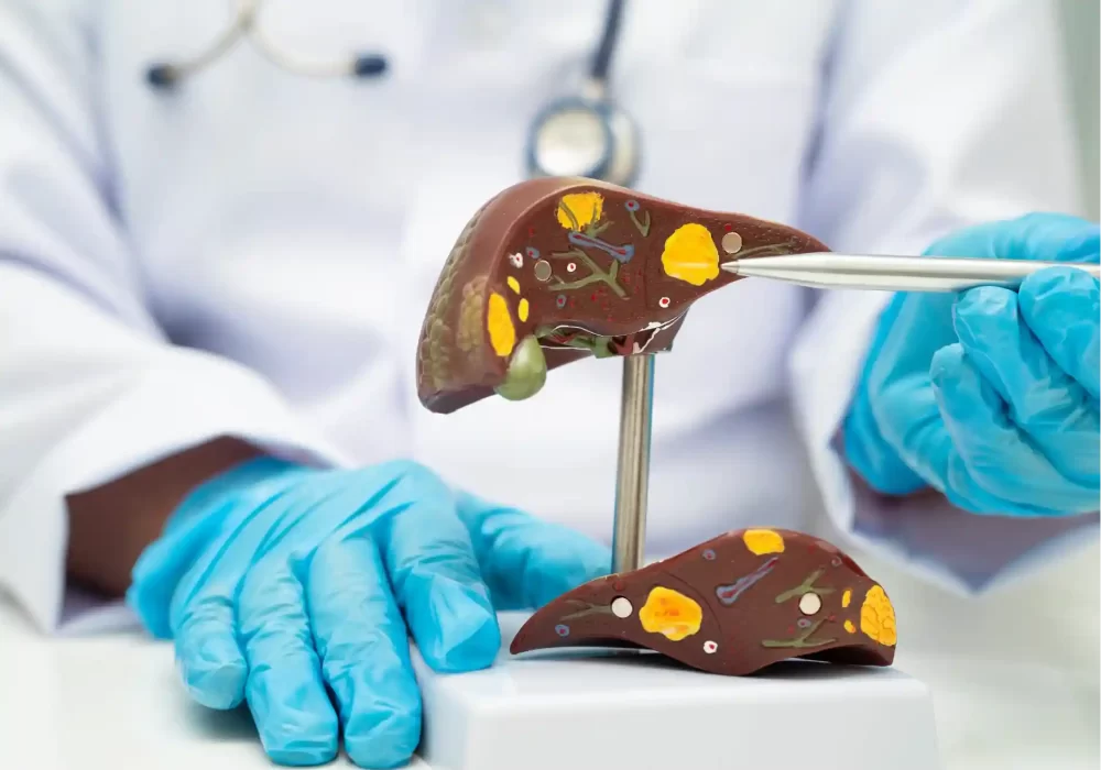 Liver cancer anatomy model