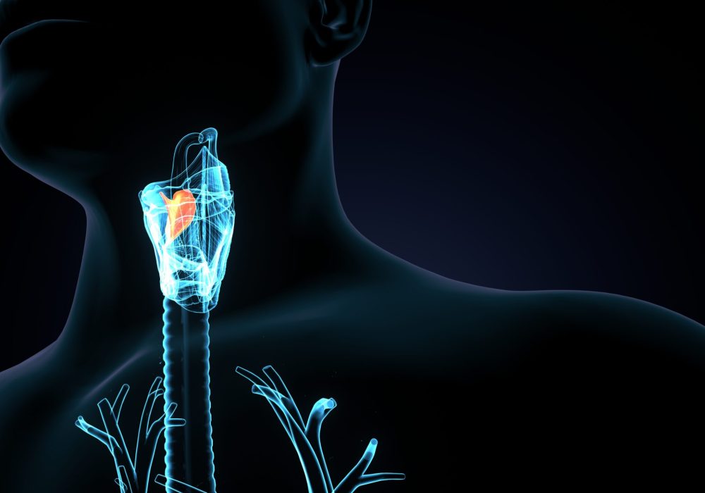 Thyroid cancer