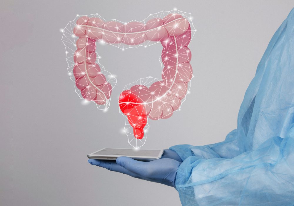 colon cancer 1